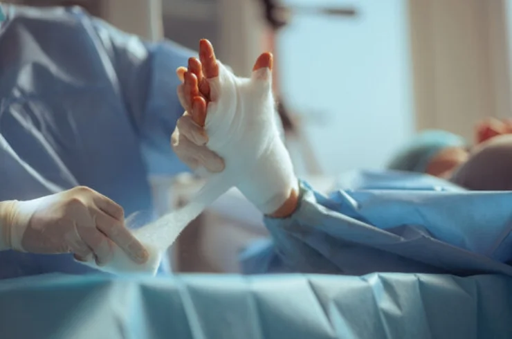 Hand Surgery